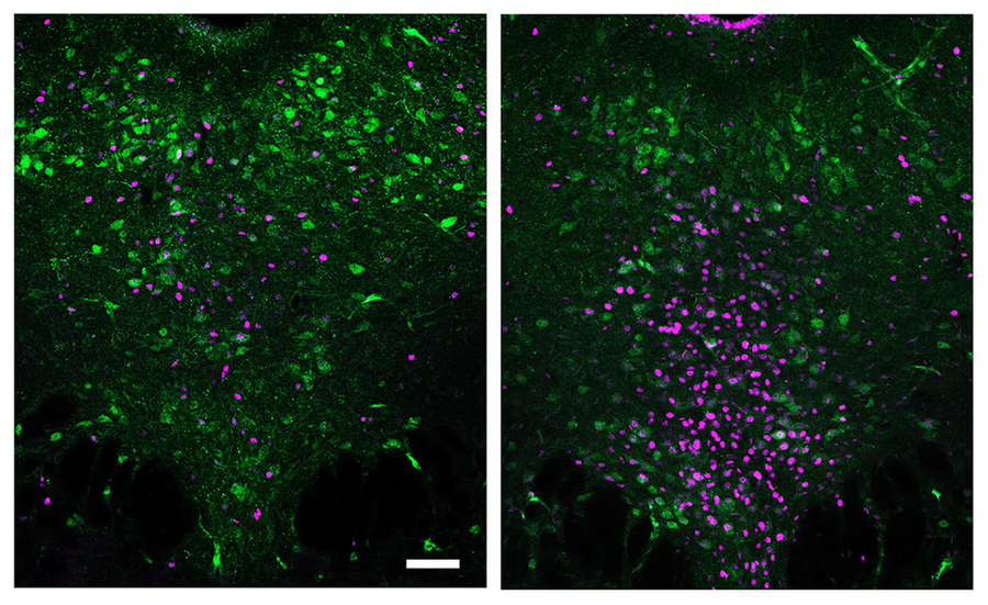 Side-by-side micrographs show the same region of brain cells lit up in green and/or magenta. There is much less magenta in the image on the left compared to the one on the right.