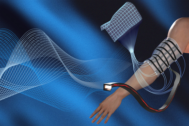 A person’s arm wrapped in a flexible sensing sheet