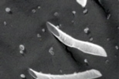 An image of peptide nanotubes.