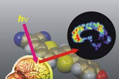 MIT scientists have found a new way to monitor Alzheimer's disease using a fluorescent marker ("bubbles" in the background). The dye enters the brain after an intravenous injection and selectively binds to the plaques associated with the disease. Subsequent scanning with a near-infrared laser beam (hv) makes it possible to monitor the plaques through the characteristic fluorescence of the dye (bla...
