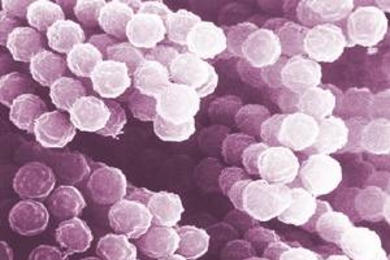 A scanning electron micrograph of one of the 
seventeen fungal species analyzed in the study.