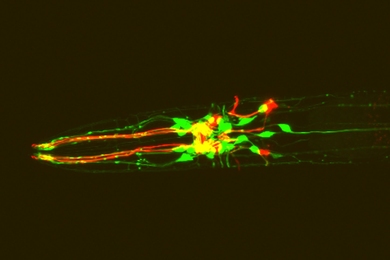 C. elegans expressing red fluorescent protein in dopamine neurons and green fluorescent protein in dopamine receptor-expressing neurons.