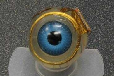 A model of the retinal implant: The coil that surrounds the iris receives visual data from a camera mounted on a pair of glasses. The coil sends the images to a chip attached to the side of the eyeball, which processes the data and sends it to electrodes implanted below the retina.