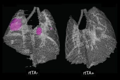 Left: Tumors are visible in the lungs of a mouse in which the NF-kappaB protein is not inhibited. Right: In the lungs of a mouse in which NF-kappaB is inhibited, tumor growth is significantly slowed. Images were taken at the Koch Institute Microscopy and Imaging Core Facility.