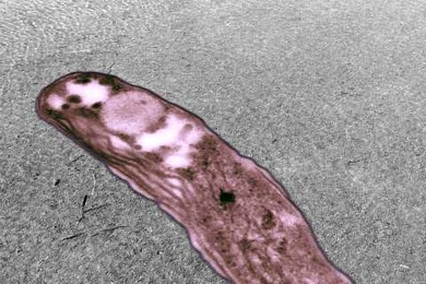 The Rhodopseudomonas palustris strain TIE-1 upon shallow sediments from the Sippewissett Salt Marsh near Woods Hole, Mass. These sediments are well known for colorful microbial assemblages dominated by purple phototrophic bacteria.