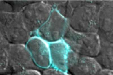 MIT researchers have designed a fluorescent probe that can be targeted to different locations within a cell. Here, the probe is labeling only proteins in the cell membrane.
