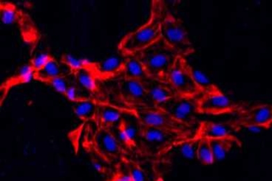 This fluorescent image shows endothelial cells embedded in a scaffold made of collagen. The cell nuclei are blue, and actin inside the cells shows up as red.