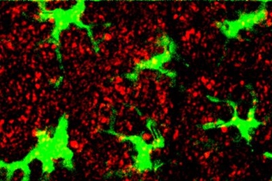 Immune cells, tagged with green fluorescent protein, are surrounded by nanoparticles (red), after the nanoparticles are injected into the skin of a mouse.