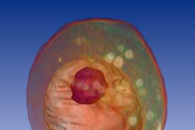 A whole yeast (Saccharomyces cerevisiae) cell viewed by X-ray microscopy. Inside, the nucleus and a large vacuole (red) are visible.