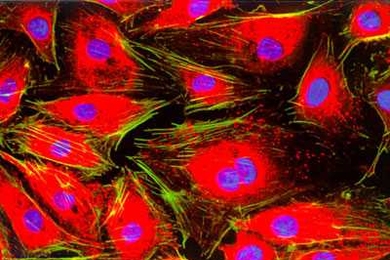 Endothelial cells