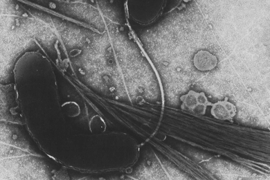 A transmission electron microscope image of <i>Vibrio choleraethat</i>.