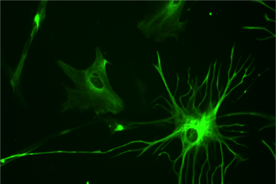 A human astrocyte cell.