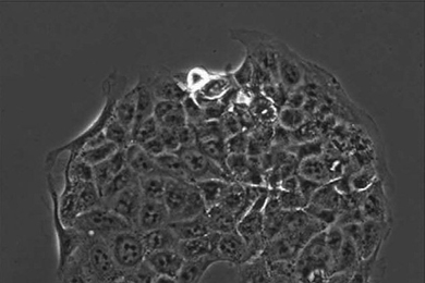 A microscopic image of cancer cells adhering to a spot coated with molecules found in the extracellular matrix. 