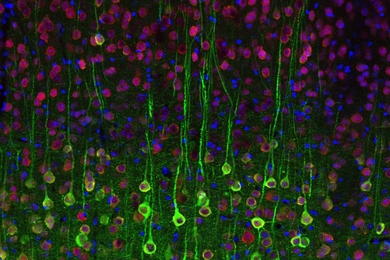 MIT neuroscientists used calcium imaging to label these pyramidal cells in the brain.