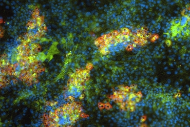 MIT researchers have generated mature liver cells from induced pluripotent stem cells. In this image, the cell nuclei are stained blue. The green stain identifies liver cells, and the red spots represent mature liver cells.