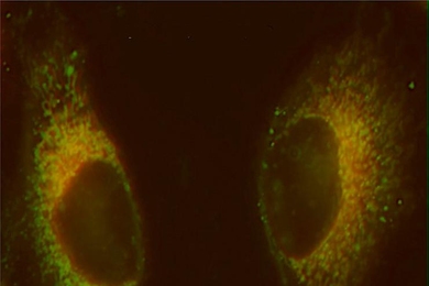 In these cells, mitochondria are labeled with a red fluorescent dye, and the platinum compound targeted to the mitochondria is labeled green. Areas where the two colors overlap, forming yellow, highlight the accumulation of platinum in the mitochondria.