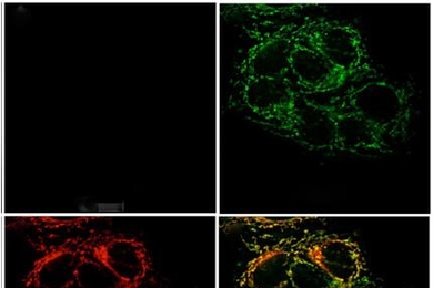Fluorescence microscopy images of live cervical cancer cells pretreated with the sensor: (Top left) minimal fluorescence, reflecting low levels of mobile zinc ions; (top right) a bright green signal appears once zinc ions are taken into the cell; (bottom left) the red fluorescence signal indicating the location of mitochondria; (bottom right) an overlay of the zinc sensor signal and mitochondrial ...