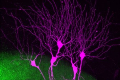 Mossy fibers (green) from dentate granule cells establish synaptic connections with CA2 pyramidal cells (violet).
