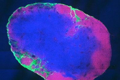 This cross section of a lymph node shows that the molecular
vaccine (green) has been taken up by immune cells in the lymph node.