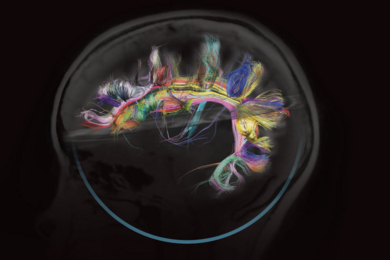 BRAIN Initiative