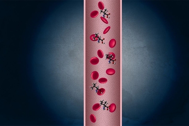 Years before they show any other signs of disease, pancreatic cancer patients have very high levels of certain amino acids in their bloodstream, according to a new study.