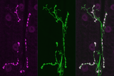 Drosophila neuron.
