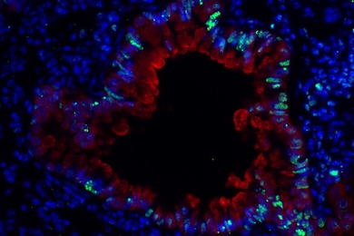 An image of epithelial cells surrounding a lung bronchiole in mice with asthma induced by dust mites. Researchers have shown that this type of asthma also produces DNA damage in lung cells, which is indicated in green.