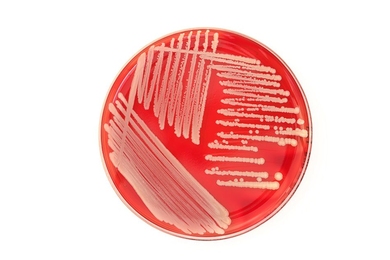 Researchers have harnessed C2c2 in bacteria to manipulate cellular RNA.
