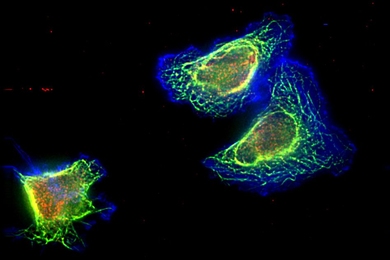 This image shows triple-negative breast cancer cells with high levels of “Mena invasive” protein and treated with Paclitaxel. The cell cytoskeleton is shown in blue, the dynamic microtubules are shown in green, and the stable microtubules are shown in red. 