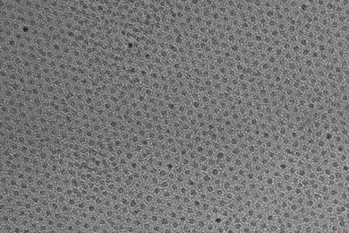 This high-resolution transmission electron micrograph of particles made by the research team shows the particles’ highly uniform size and shape. These are iron oxide particles just 3 nanometers across, coated with a zwitterion layer. Their small size means they can easily be cleared through the kidneys after injection.
