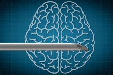 Professor Michael Cima and his colleagues are now designing brain implants that can not only deliver electrical stimulation but also record brain activity or deliver drugs to very targeted locations.
