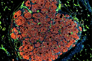 Researchers have developed a new way to engineer liver tissue by organizing tiny subunits that contain three types of cells embedded into a biodegradable tissue scaffold. This image shows vascularized engineered human liver tissue that has self-organized into a lobule-like microstructure.
