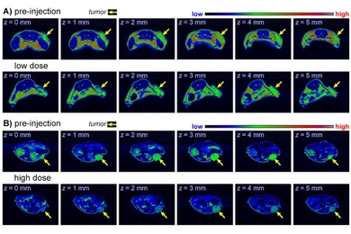 Researchers have developed a metal-free contrast agent for MRI scans, which could be safer for certain patients.
