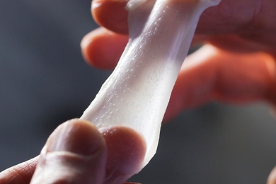 MIT alumnus Dennis Orgill developed a process of infusing scaffolds — collagen skin grafts — with healthy skin cells to promote a more effective regeneration. The scaffold was invented by Professor Ioannis Yannas. 