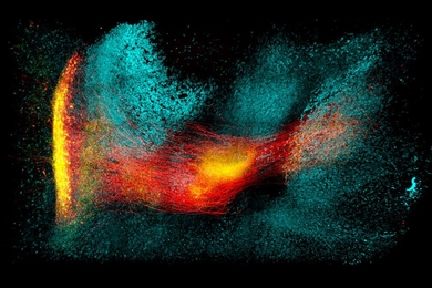 MIT researchers used their new tissue preservation technique to label and image neurons in a brain region called the globus pallidus externa. Neurons that express a protein called parvalbumin are labeled in red, and neurons labeled blue express a protein called GAD1. 