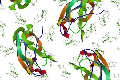 MIT chemists have enhanced the resolution of nuclear magnetic resonance (NMR), which should allow more rapid and detailed study of proteins such as the beta amyloid protein that accumulates in the brains of Alzheimer’s patients.