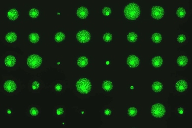 MIT biological engineers have developed a way to rapidly measure cell survival rates by growing many cell colonies and imaging their fluorescently labeled DNA.