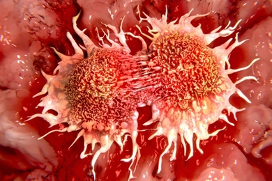 Researchers at the Koch Institute for Integrative Cancer Research at MIT have developed a new approach to targeting tumors and metastases.