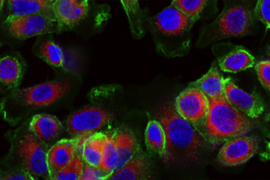 Cancer cells targeted with nanoparticles built in the Hammond laboratory