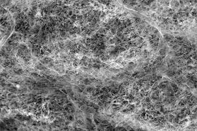 A scanning electron microscope (SEM) image of the polymer network that makes up mucins.