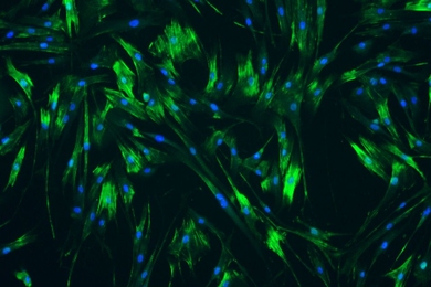 MIT engineers used human ureteral smooth muscle cells grown in a lab dish to identify drugs that would help to relax the muscle cells.