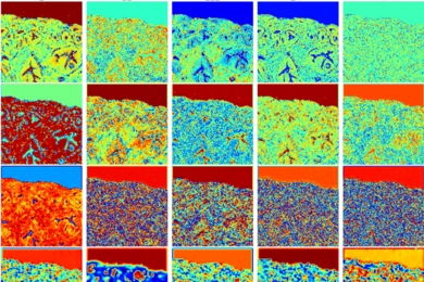 Activation maps of neural network model for digital staining of tumors
