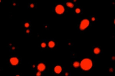 The cancer drug cisplatin concentrates in MED1 droplets in vitro.