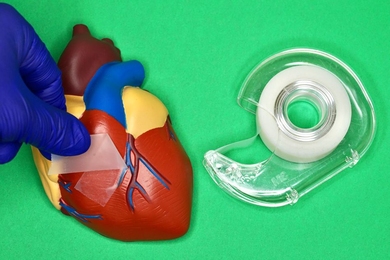 “This is like a painless Band-Aid for internal organs,” says Xuanhe Zhao, professor in the departments of mechanical engineering and civil and environmental engineering at MIT. “You put the adhesive on, and if for any reason you want to take it off, you can do so on demand, without pain.”