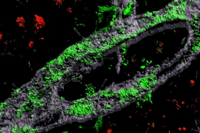 In Alzheimer's disease, the blood-brain barrier can become disrupted by the accumulation of amyloid protein, especially in people who carry a genetic variant called APOE4. This 3D rendering of an APOE4-carrying engineered blood vessel shows heavy accumulation of amyloid protein (green).