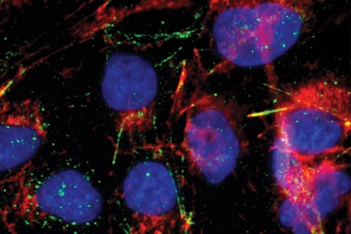RNA-binding proteins (green) are visible in these hepatocyte carcinoma cells. The cell nuclei are labeled blue, and actin proteins are labeled red.