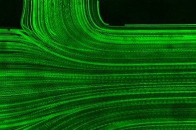Time-lapse microscopic images of particle-based flow visualization inside a ventricular catheter. The image shows the confluence of three flows: the upstream flow coming from the catheter tip direction and two flows coming in via holes facing each other. Obtained from combined fluorescent microscopy videography and optical distortion correction via fluid index matching. 