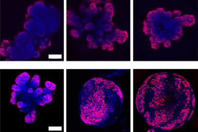 cell division marker Ki67