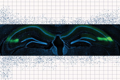 CA2 region of the hippocampus