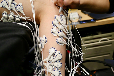 better prosthetics